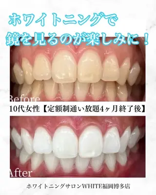 メンズ キッズ セルフホワイトニング WHITE福岡博多店のエステ・リラクイメージ