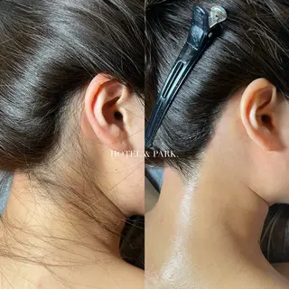 ロング HOTEL&PARK . ワックス脱毛のエステ・リラクイメージ