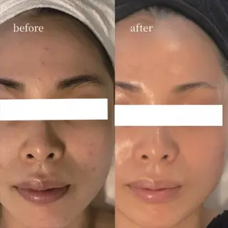 韓国肌管理・肌質改善 EARNEST心斎橋のエステ・リラクイメージ