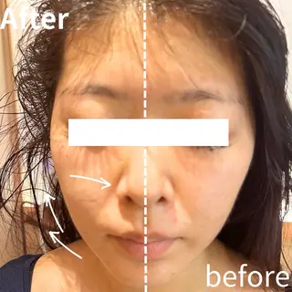 美BARI新宿店 RINAのエステ・リラクイメージ