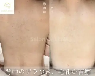 ハーブピーリング専門 グランディール　武内のエステ・リラクイメージ