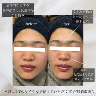 アイブロウ Lea堺東　毛穴洗浄 ×顔ワックス脱毛のその他イメージ