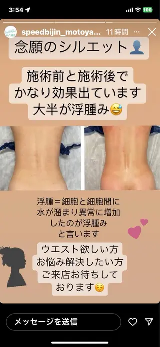 セルライトクラッシュ ＆腸もみ＋骨盤矯正のその他イメージ