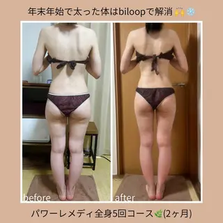 《本気痩せ×疲労改善 》  BILOOPのエステ・リラクイメージ