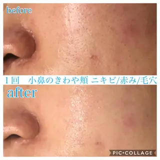 ミディアム カラー パーマ ヘアアレンジ メンズ EnsorClair 代表　野口真央のエステ・リラクイメージ