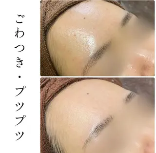 ハーブピーリング専門 BIOPLUS+川崎のエステ・リラクイメージ