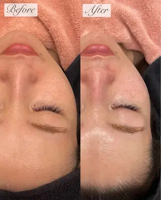 emiluca西目/ 毛穴洗浄/細胞美容のエステ・リラクイメージ