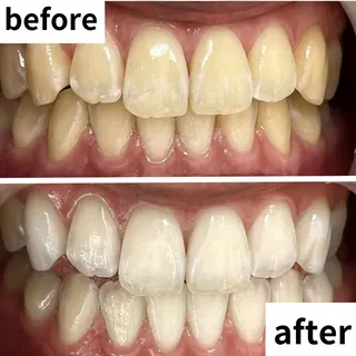 LBSホワイトニング 🌐渋谷店 河内のエステ・リラクイメージ