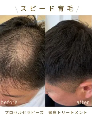 毛穴・頭皮 専門店💪のその他イメージ