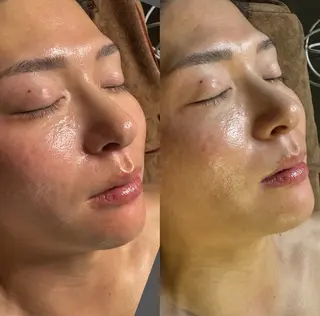 六本木脱毛andS 店長Sachiのエステ・リラクイメージ