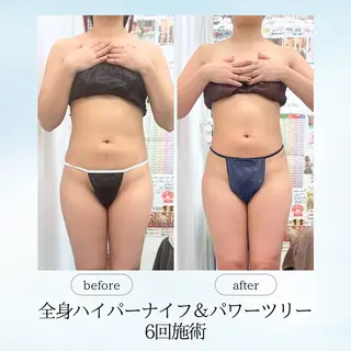 espresso,所属・《痩身、小顔専門店》 エスプレッソのエステ・リラクイメージ