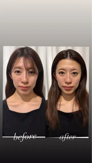 美容鍼灸サロン mahoroba院長のエステ・リラクイメージ
