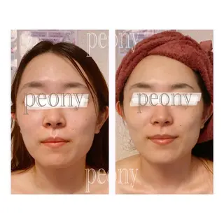 デトックス美容専門 サロンpeonyのエステ・リラクイメージ