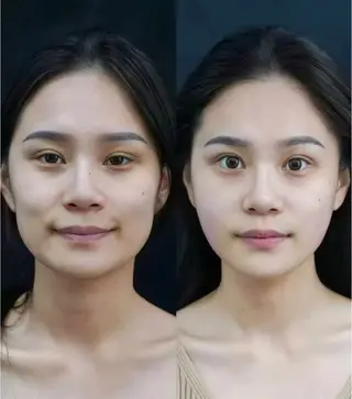 ネイル aliaハーブ水光店 エステティシャン募集のエステ・リラクイメージ