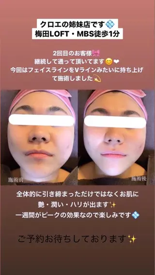 セミロング カラー パーマ ヘアアレンジ メンズ キッズ ネイル マツエク・マツパ Chloe-クロエ- 脱毛/フェイシャルのエステ・リラクイメージ