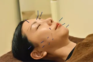 repos鍼灸整骨院所属・repos 鍼灸整骨院のエステ・リラクイメージ