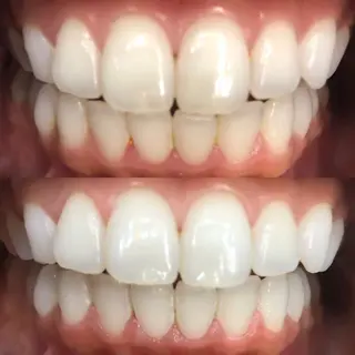 LBSホワイトニング 🌐 上野店公式のエステ・リラクイメージ