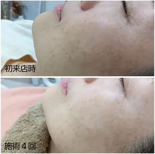 シミケア専門店 HAQUAのエステ・リラクイメージ