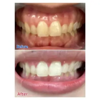 Ｍ渋谷 ホワイトニングのエステ・リラクイメージ