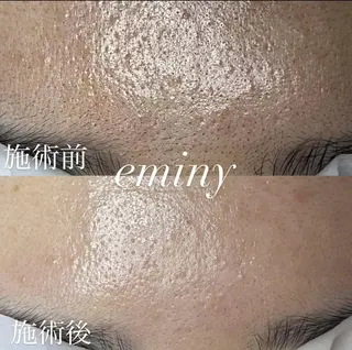 EMINY (エステティシャン)のエステ・リラクイメージ