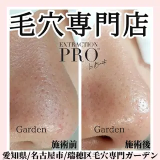 プライベートサロン Gardenのエステ・リラクイメージ