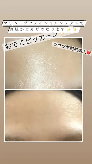 宜野湾美肌脱毛fuu okinawaタイラのエステ・リラクイメージ