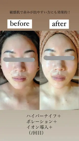 km retreat mentのエステ・リラクイメージ