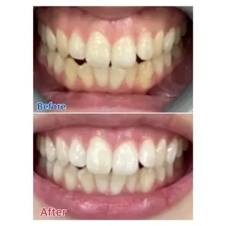 Ｍ渋谷 ホワイトニングのエステ・リラクイメージ