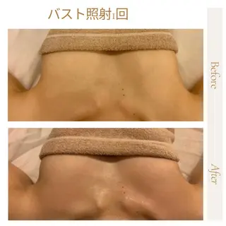 ピーリング＆脱毛 maoのエステ・リラクイメージ