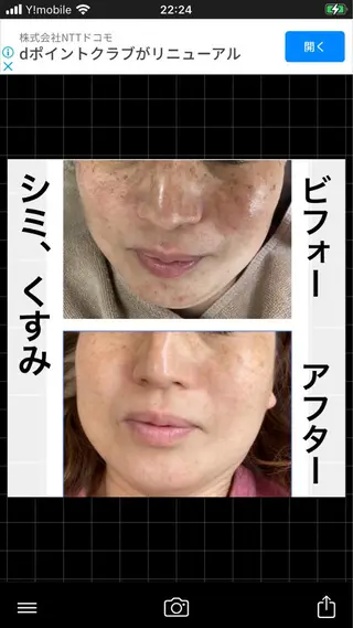 ショート カラー パーマ ヘアアレンジ メンズ キッズ ネイル マツエク・マツパ アイブロウ ハーブピーリング専門 🌿モッカのエステ・リラクイメージ