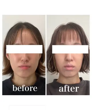 小顔と ヘッドスパのお店のエステ・リラクイメージ