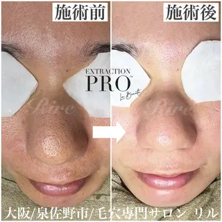 隅田 都布子のマツエク・マツパデザイン