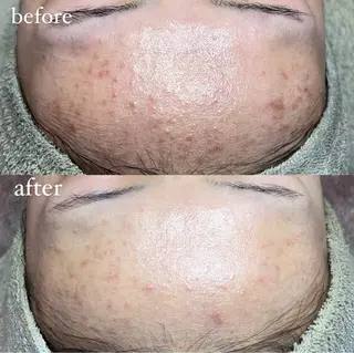 beautysalonW所属・beauty salonWのエステ・リラクイメージ