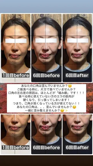 💎後悔させない小顔 矯正💎イトヤマ🌱のエステ・リラクイメージ