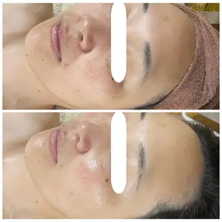 Linoa（リノア） エステ&リラクのエステ・リラクイメージ