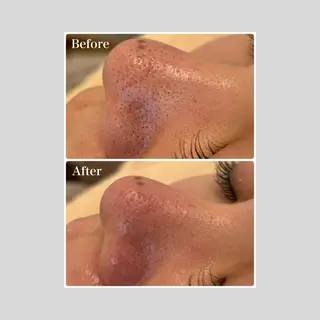 マツエク・マツパ 韓国肌管理 【毛穴専科】のエステ・リラクイメージ