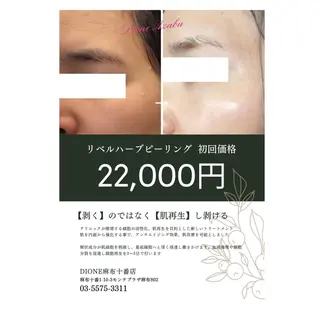 DIONE 麻布十番店のエステ・リラクイメージ