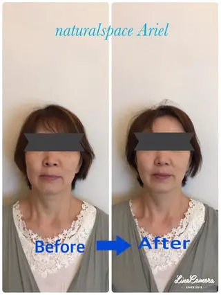 町田・鶴川 小顔矯正 /鈴木友実のエステ・リラクイメージ