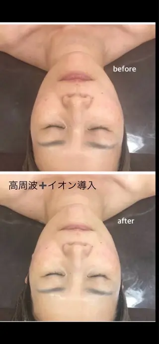 女性専用エステルーム Rerelaリレラのエステ・リラクイメージ