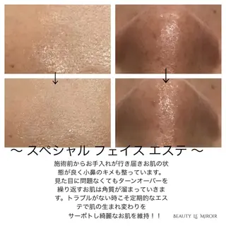 ビューティー ミロワールのエステ・リラクイメージ