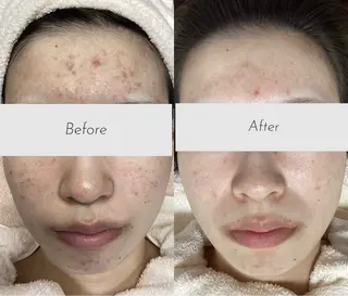 都度払い 肌質改善専門サロンのエステ・リラクイメージ