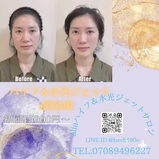 マツエク・マツパ aliaハーブ水光店 エステティシャン募集のエステ・リラクイメージ