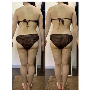 ハイパーナイフ専門店　Salon de COCO所属・Salon de COCOのエステ・リラクイメージ