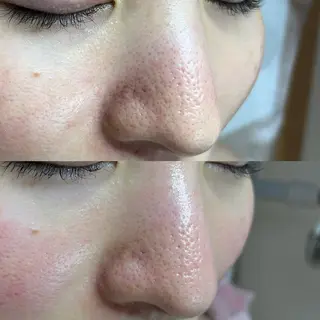 毛穴ケア・ヘッドスパサロンSHINY(シャイニー)所属・毛穴ケア・ヘッドスパ サロンSHINYのエステ・リラクイメージ