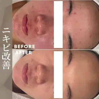 肌育成サロン ♡ RISAのエステ・リラクイメージ