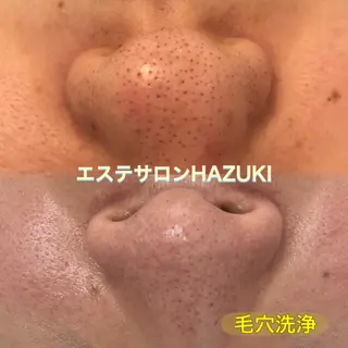 たるみ改善小顔エステ 堀葉月のその他イメージ