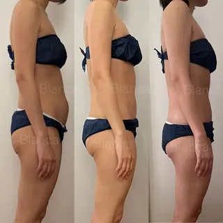 Blanca 錦糸町店のマツエク・マツパデザイン