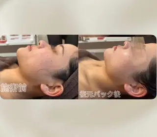 浮腫|肩こり|張り 日々の疲れを解消★のエステ・リラクイメージ