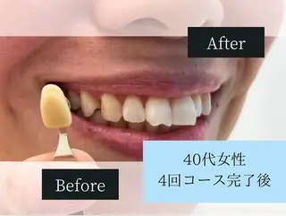 ホワイトニングカフェ荻窪店所属・ホワイトニングカフェ 荻窪店のその他イメージ