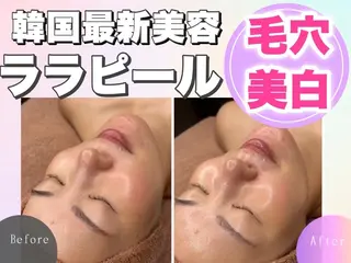 中目黒ハーブピーリン グ🌿ララピールのエステ・リラクイメージ